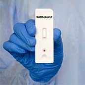 Test rápido de antígenos en Barcelona  Clínica Corachan  al precio de 30€